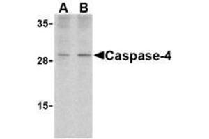 Western blot analysis of caspase-4 in human spleen cells with AP30198PU-N caspase-4 antibody at (A) 1 and (B) 2 μg/ml. (Caspase 4 抗体  (Intermediate Domain))