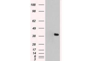 Image no. 11 for anti-Mitogen-Activated Protein Kinase 1 (MAPK1) antibody (ABIN1499291)