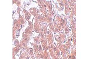 Immunohistochemical staining of human brain tissue with 5 ug/mL FAM59A polyclonal antibody . (FAM59A 抗体  (C-Term))