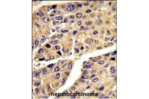 Immunohistochemistry (Paraffin-embedded Sections) (IHC (p)) image for anti-Insulin-Like Growth Factor Binding Protein, Acid Labile Subunit (IGFALS) (AA 308-335) antibody (ABIN391690)