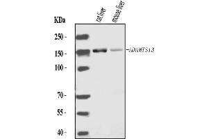 Western blot analysis of ADAMTS13 using anti-ADAMTS13 antibody (ABIN7601168).