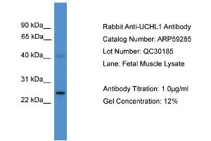 WB Suggested Anti-UCHL1  Antibody Titration: 0. (UCHL1 抗体  (C-Term))