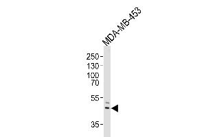 Western blot analysis of lysate from MDA-MB-453 cell line, using IL5RA Antibody (N-term) (ABIN651428 and ABIN2840234). (IL5RA 抗体  (N-Term))