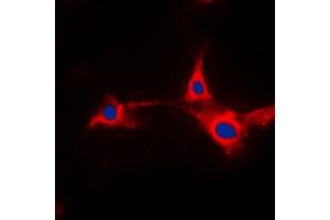Immunofluorescent analysis of PFKFB2 staining in HepG2 cells. (PFKFB2 抗体  (N-Term))