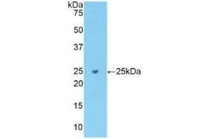 Detection of Recombinant Fibronectin, Rat using Polyclonal Antibody to Fibronectin (FN) (Fibronectin 抗体  (AA 355-558))