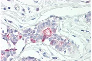 Image no. 3 for anti-Tumor Necrosis Factor, alpha-Induced Protein 8 (TNFAIP8) (AA 31-80) antibody (ABIN2879136) (TNFAIP8 抗体  (AA 31-80))