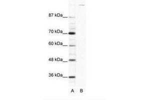 Image no. 1 for anti-Zinc Finger Protein GLI1 (GLI1) (AA 1007-1056) antibody (ABIN202974)