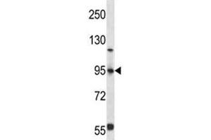 FOXP4 antibody western blot analysis in 293 lysate (FOXP4 抗体  (AA 522-550))