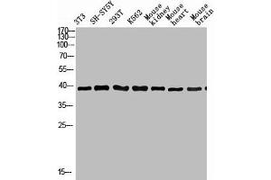 Western Blot analysis of various cells using Antibody diluted at 1:1000. (KIR3DL1 抗体  (N-Term))