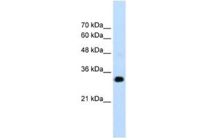 Western Blotting (WB) image for anti-Ring Finger Protein 121 (RNF121) antibody (ABIN2462677) (RNF121 抗体)