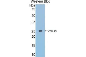 Detection of Recombinant Slit3, Mouse using Polyclonal Antibody to Slit Homolog 3 (Slit3) (SLIT3 抗体  (AA 1348-1517))