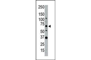 Image no. 1 for anti-SUMO1/sentrin Specific Peptidase 1 (SENP1) (N-Term) antibody (ABIN356749)