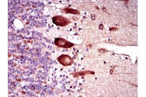 Immunohistochemical analysis of paraffin-embedded cerebellum tissues using KEAP1 mouse mAb with DAB staining. (KEAP1 抗体  (AA 380-624))