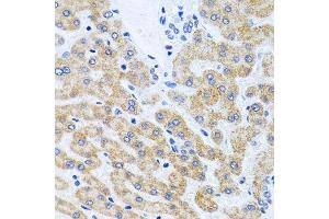 Immunohistochemistry (Paraffin-embedded Sections) (IHC (p)) image for anti-SCO1 Cytochrome C Oxidase Assembly Protein (SCO1) (AA 1-160) antibody (ABIN6147455)