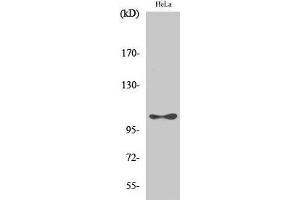 Western Blot analysis of Hela cells with Phospho-eEF2K (Ser366) Polyclonal Antibody at dilution of 1:1000 (EEF2K 抗体  (pSer366))