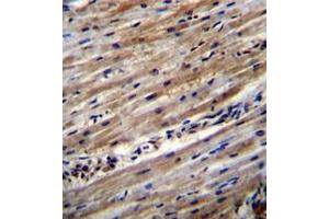 Formalin fixed and paraffin embedded human heart tissue reacted with DUS1L Antibody (C-term) followed by peroxidase conjugation of the secondary antibody and DAB staining. (DUS1L 抗体  (C-Term))