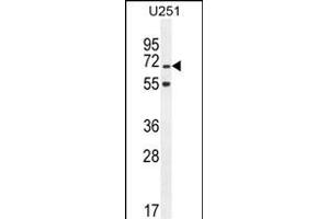 TNIP1 Antibody (C-term) (ABIN654978 and ABIN2844618) western blot analysis in  cell line lysates (35 μg/lane). (TNIP1 抗体  (C-Term))