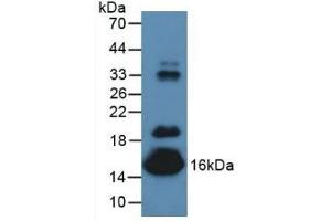 Detection of PALB in Mouse Serum using Polyclonal Antibody to Prealbumin (PALB) (TTR 抗体  (AA 21-147))