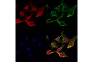 ABIN6265813 and ABIN6272621 staining Hela cells by IF/ICC. (TXK 抗体  (N-Term))