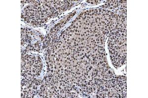 IHC analysis of HNRNPL using anti-HNRNPL antibody (ABIN4886624).