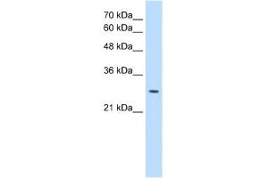 EBP antibody used at 0. (EBP 抗体)