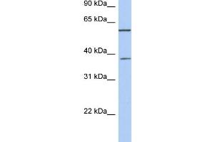 WB Suggested Anti-NUP43 Antibody Titration: 0. (NUP43 抗体  (Middle Region))