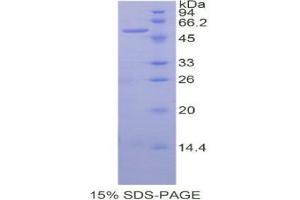 SDS-PAGE (SDS) image for Sialic Acid Acetylesterase (SIAE) (AA 22-244) protein (His tag,GST tag) (ABIN1877273) (SIAE Protein (AA 22-244) (His tag,GST tag))
