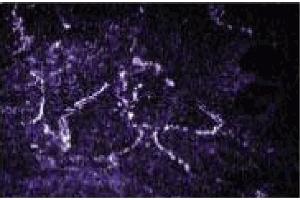 Immunofluorescence staining of L6 cells (rat skeletal muscle myoblasts, ATCC CRL-1458). (Rab4 抗体  (AA 97-213))