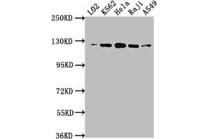 Western Blot Positive WB detected in: L02 whole cell lysate, K562 whole cell lysate, Hela whole cell lysate, Raji whole cell lysate, A549 whole cell lysate All lanes: ACLY antibody at 1:1500 Secondary Goat polyclonal to rabbit IgG at 1/50000 dilution Predicted band size: 121, 120, 92 kDa Observed band size: 120 kDa (Recombinant ACLY 抗体)