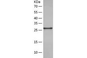 Western Blotting (WB) image for Exosome Component 3 (EXOSC3) (AA 1-275) protein (His tag) (ABIN7122862) (EXOSC3 Protein (AA 1-275) (His tag))