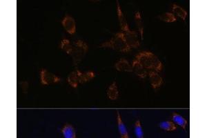 Immunofluorescence analysis of NIH/3T3 cells using Perforin Polyclonal Antibody at dilution of 1:100. (Perforin 1 抗体)