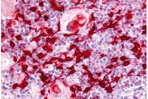 Human Thymus (formalin-fixed, paraffin-embedded) stained with USP4 antibody ABIN213586 at 5 ug/ml followed by biotinylated goat anti-rabbit IgG secondary antibody ABIN481713, alkaline phosphatase-streptavidin and chromogen. (USP4 抗体  (Internal Region))