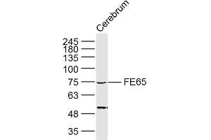 Western Blotting (WB) image for anti-Amyloid beta (A4) Precursor Protein-Binding, Family B, Member 1 (Fe65) (APBB1) (AA 201-300) antibody (ABIN725075)