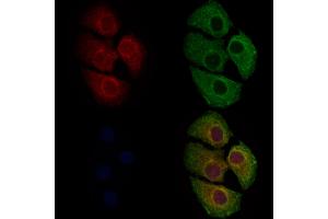 ABIN6262169 and ABIN6279682 staining Hela cells by IF/ICC. (HCN3 抗体  (C-Term))