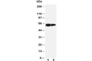 Western blot testing of IL-2 Receptor antibody and Lane 1:  PANC cell lysate ;  2: HeLa cell lysate. (IL2 Receptor beta 抗体  (AA 117-135))