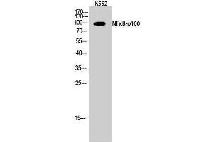 Western Blotting (WB) image for anti-Nuclear Factor of kappa Light Polypeptide Gene Enhancer in B-Cells 2 (NFKB2) (Thr160) antibody (ABIN3176318) (NFKB2 抗体  (Thr160))