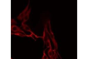 ABIN6276757 staining LOVO by IF/ICC. (MMP13 抗体  (N-Term))