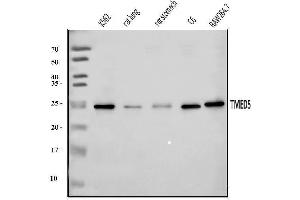 Western blot analysis of TMED5/p28 using anti-TMED5/p28 antibody (ABIN7601339).