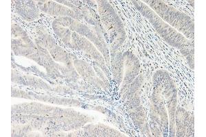 Image no. 2 for anti-Chemokine (C-X-C Motif) Ligand 5 (CXCL5) antibody (ABIN465535) (CXCL5 抗体)
