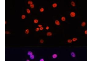 Immunofluorescence analysis of HeLa cells using MYCT1 Polyclonal Antibody at dilution of 1:100. (Myc Target 1 抗体)