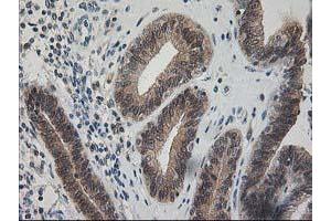 Image no. 1 for anti-Pyridoxal Kinase (PDXK) antibody (ABIN1500145) (PDXK 抗体)