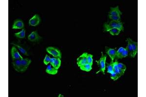Immunofluorescent analysis of MCF-7 cells using ABIN7173139 at dilution of 1:100 and Alexa Fluor 488-congugated AffiniPure Goat Anti-Rabbit IgG(H+L) (FAM156A 抗体  (AA 251-519))