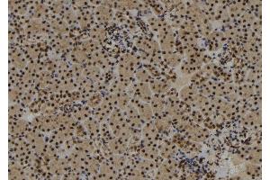 ABIN6273017 at 1/100 staining Mouse kidney tissue by IHC-P. (SYNPO2 抗体  (Internal Region))