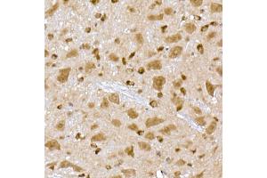 Immunohistochemistry of paraffin-embedded mouse brain using PPCS Rabbit mAb (ABIN7269360) at dilution of 1:25 (40x lens).