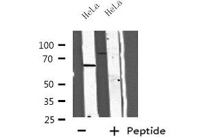 Western blot analysis of extracts from HeLa cells, using CC14A antibody. (CDC14A 抗体  (Internal Region))
