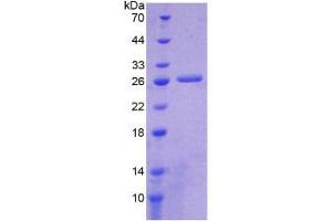 SDS-PAGE analysis of Human ICA1 Protein. (ICA1 蛋白)
