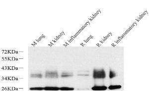 Western Blot analysis of various samples using AQP1 Polyclonal Antibody at dilution of 1:2000. (Aquaporin 1 抗体)