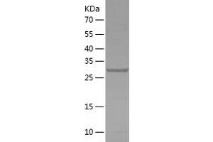 Western Blotting (WB) image for Phosphatase, Orphan 1 (PHOSPHO1) (AA 1-267) protein (His tag) (ABIN7124394) (PHOSPHO1 Protein (AA 1-267) (His tag))