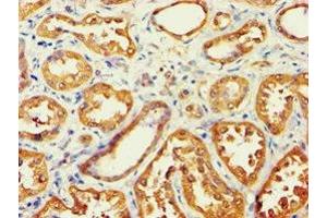 Immunohistochemistry of paraffin-embedded human kidney tissue using ABIN7143588 at dilution of 1:100 (AKR7A3 抗体  (AA 1-331))