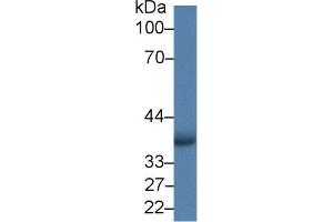 Detection of AIM2 in Human A549 cell lysate using Polyclonal Antibody to Absent In Melanoma 2 (AIM2) (AIM2 抗体  (AA 1-343))